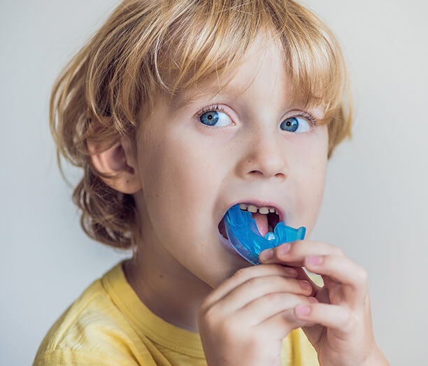 mouthguards